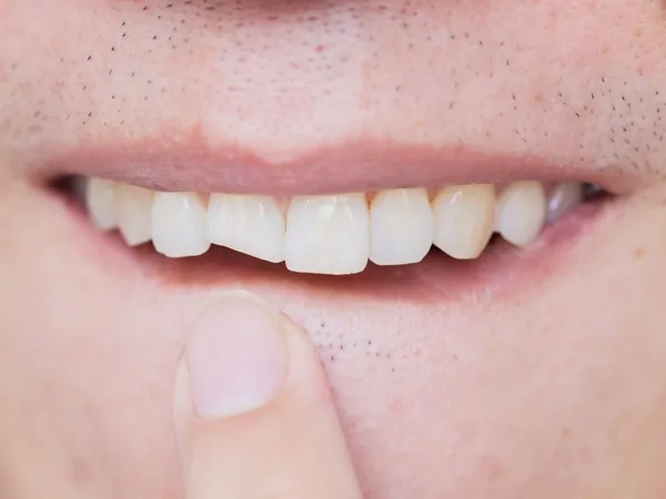 Facial trauma repair