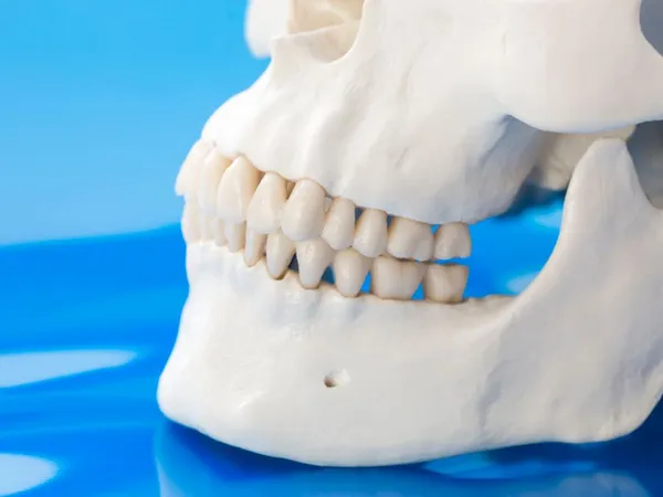Jawbone loss and deterioration